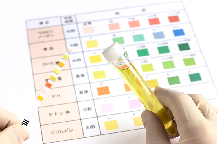 腎臓内科のイメージ